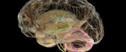 brain image